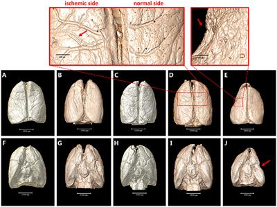 Non-destructive 3D Microtomography of Cerebral Angioarchitecture Changes Following Ischemic Stroke in Rats Using Synchrotron Radiation